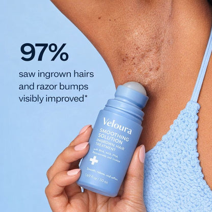 Veloura™ Ingrown Solution